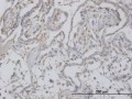 Monoclonal Anti-CLIC1 antibody produced in mouse