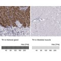 Anti-TH antibody produced in rabbit
