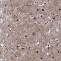 Anti-RAVER2 antibody produced in rabbit